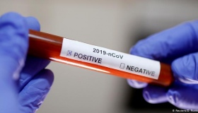 Експрес-тестів для виявлення коронавірусу Полтавщина досі не має