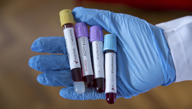 На Полтавщині за добу - плюс 543 нових випадки коронавірусу