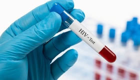 Усі охочі можуть пройти безкоштовне тестування на ВІЛ/СНІД