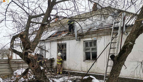 Під час пожежі на Лубенщині жінка отримала 50% опіків тіла
