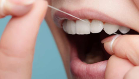 Чищення зубного каменю в домашніх умовах - міф чи реальність