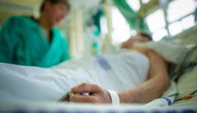 Чоловік потрапив до реанімації з опіками від спалаху газу