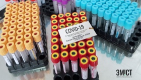 Полтавці куплять ще один прилад для діагностики коронавірусу