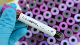 В області зафіксували 61 випадок коронавірусу