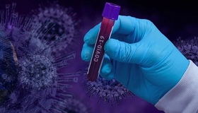 На Полтавщині за добу зафіксували шість нових випадків COVID-19