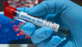 У Полтаві виявили 174 нові випадки захворювання на COVID-19