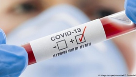 COVID-19: зафіксовано понад сто захворювань за минулу добу