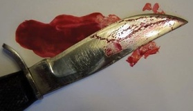 На Полтавщині під час сварки чоловік отримав ножове поранення