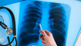 На Полтавщині зросла кількість хворих на туберкульоз