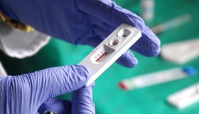 Полтавці провели безкоштовне експрес-тестування на виявлення ВІЛ