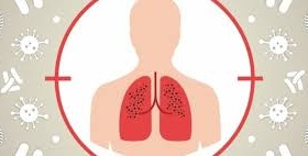 Полтавщина – п’ята в Україні за рівнем захворюваності на туберкульоз
