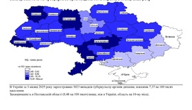 У 114 жителів Полтавської області виявили туберкульоз