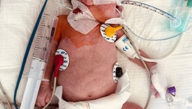 В Інституті серця врятували немовля з Полтави